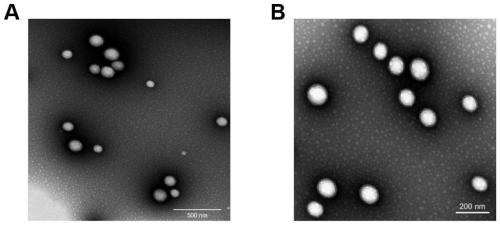 Novel graded targeted nanoparticles for mediating phototherapy and preparation method and application of novel graded targeted nanoparticles