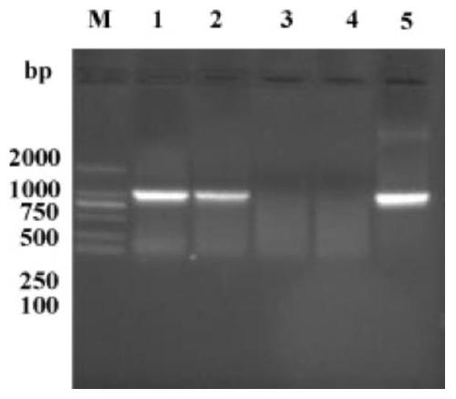 A kind of recombinant BCG strain overexpressing Mycobacterium tuberculosis rv3586 and its application