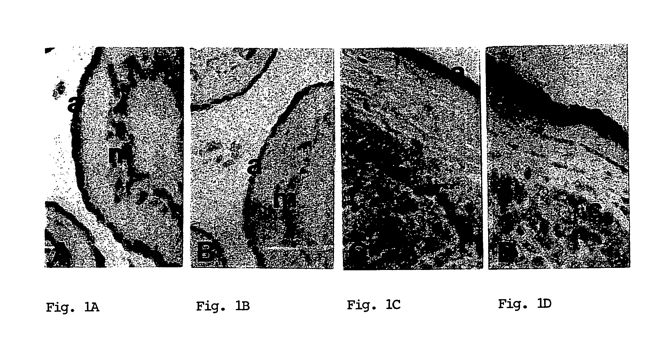 Methods for diagnosing and treating pre-term labor