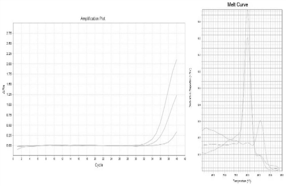 Circular RNA detection method and kit