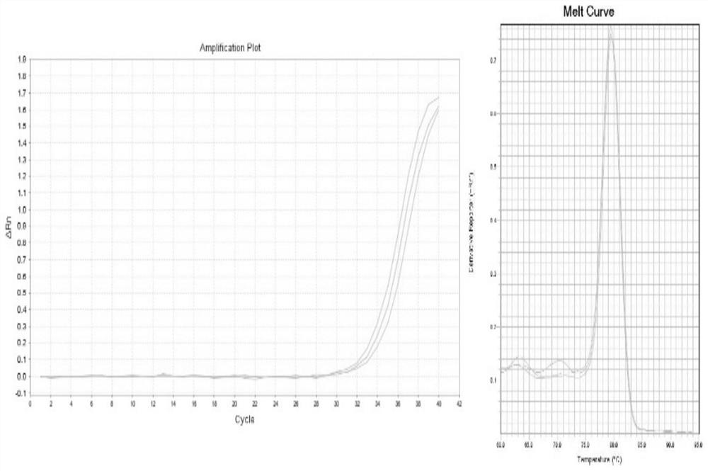 Circular RNA detection method and kit