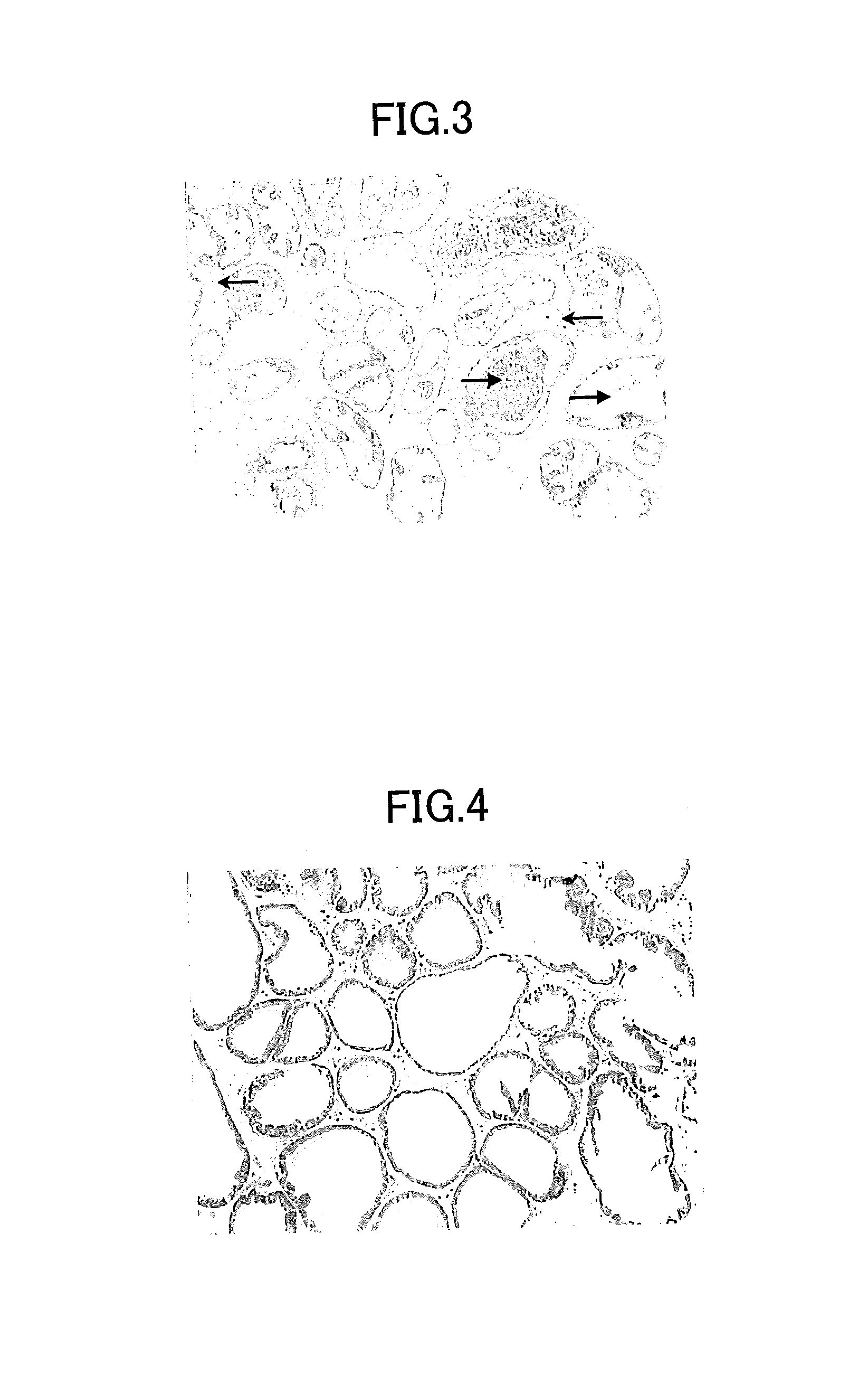 Therapeutic agent for a lower urinary tract disease and an agent for improving a lower urinary tract symptom