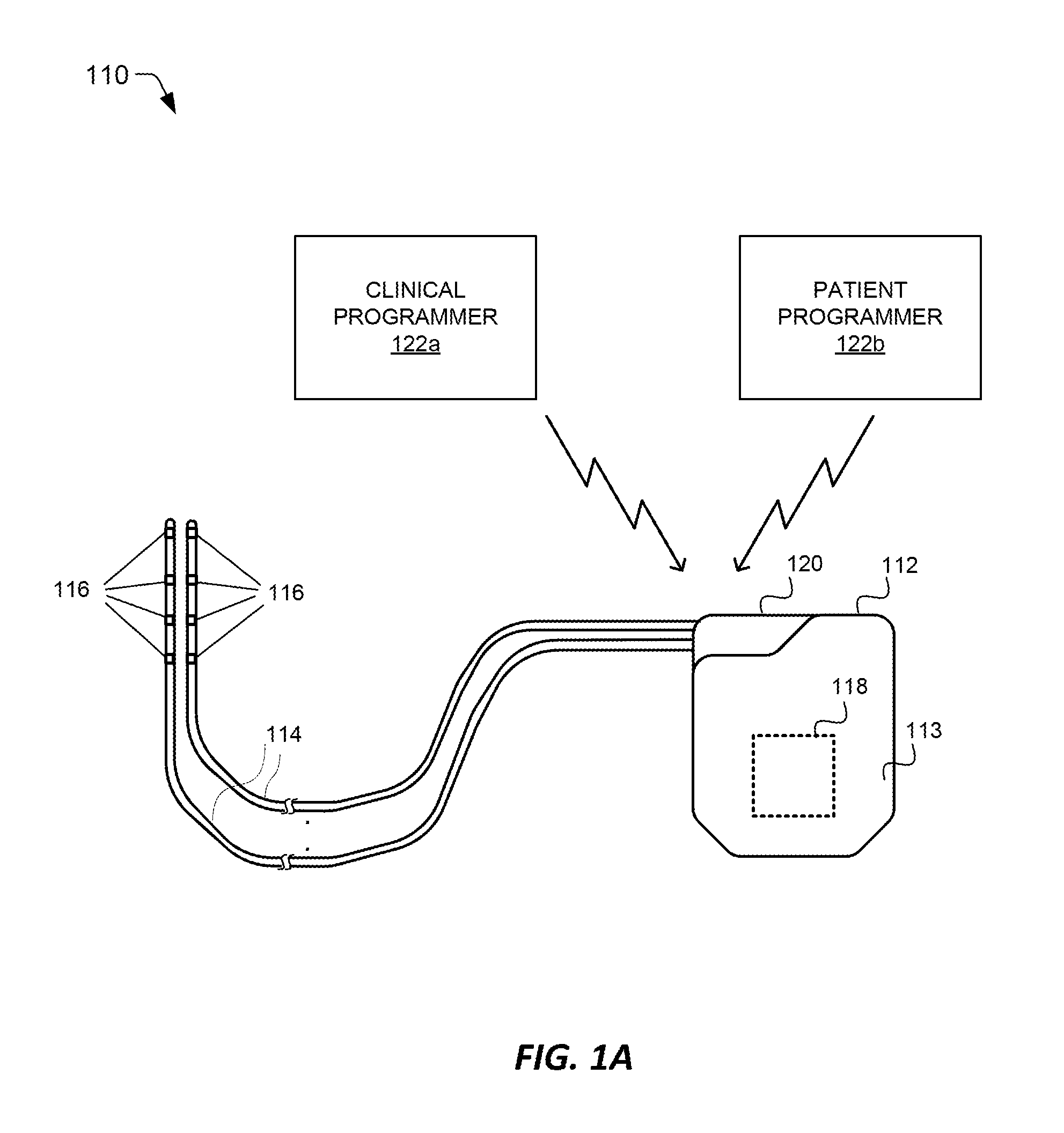 Methods and systems for automatically turning on and off DRG stimulation and adjusting DRG stimulation parameters