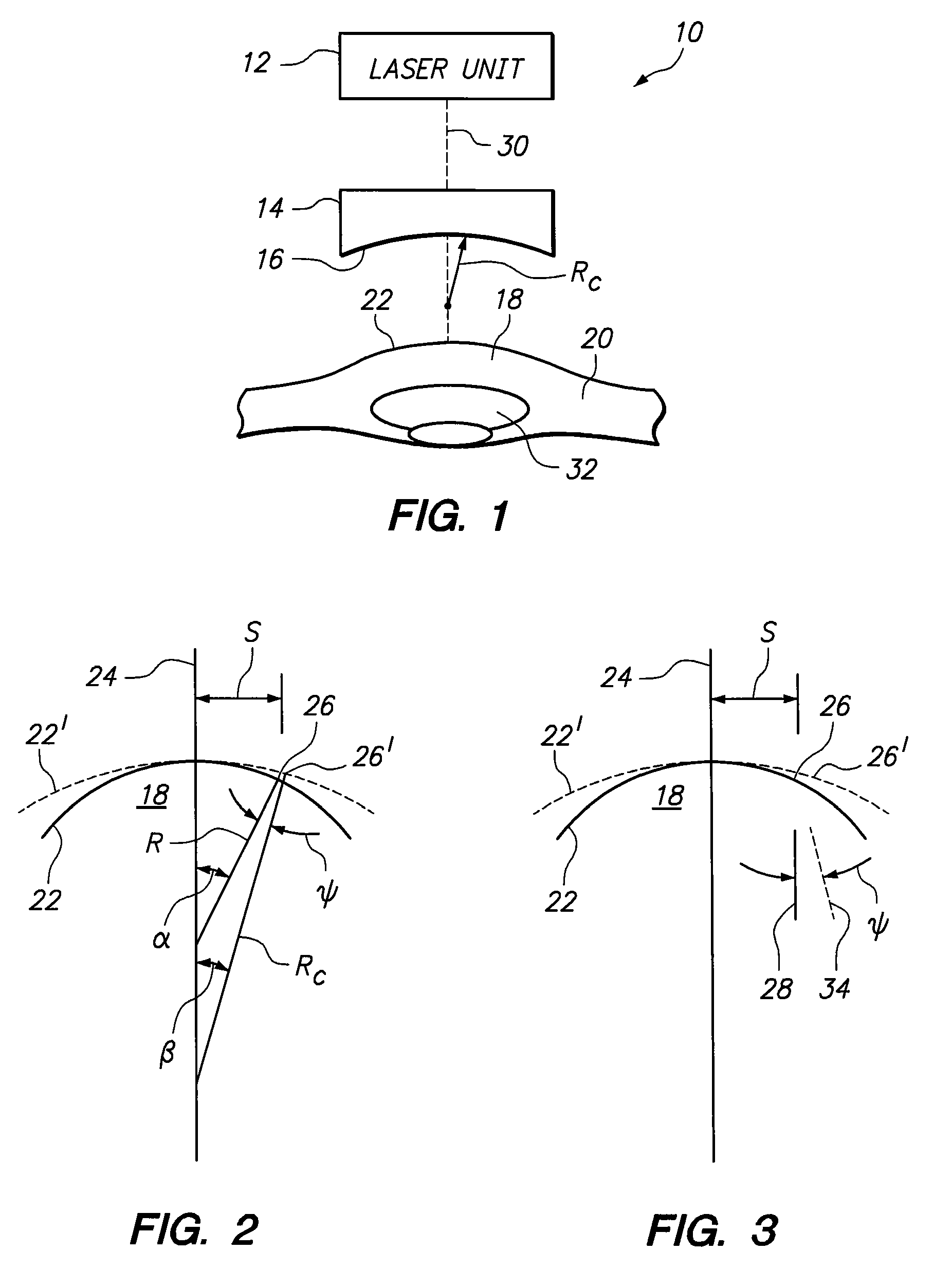 System and method for stray light compensation of corneal cuts