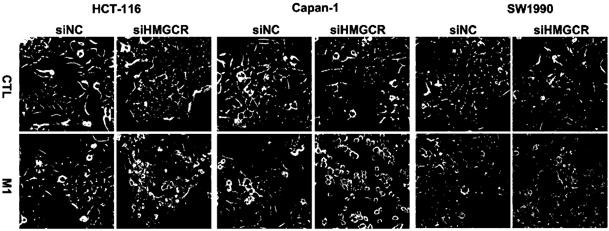 Application of mevalonic acid metabolism pathway inhibitor and alphavirus in preparing antitumor drug