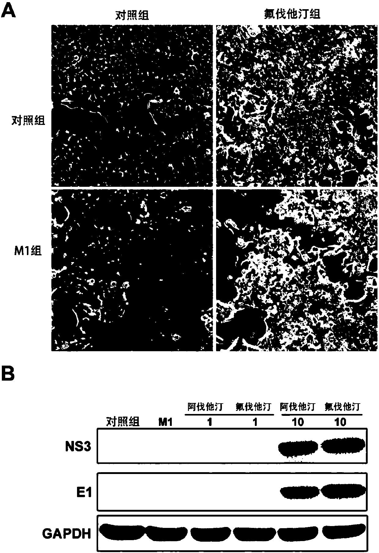 Application of mevalonic acid metabolism pathway inhibitor and alphavirus in preparing antitumor drug