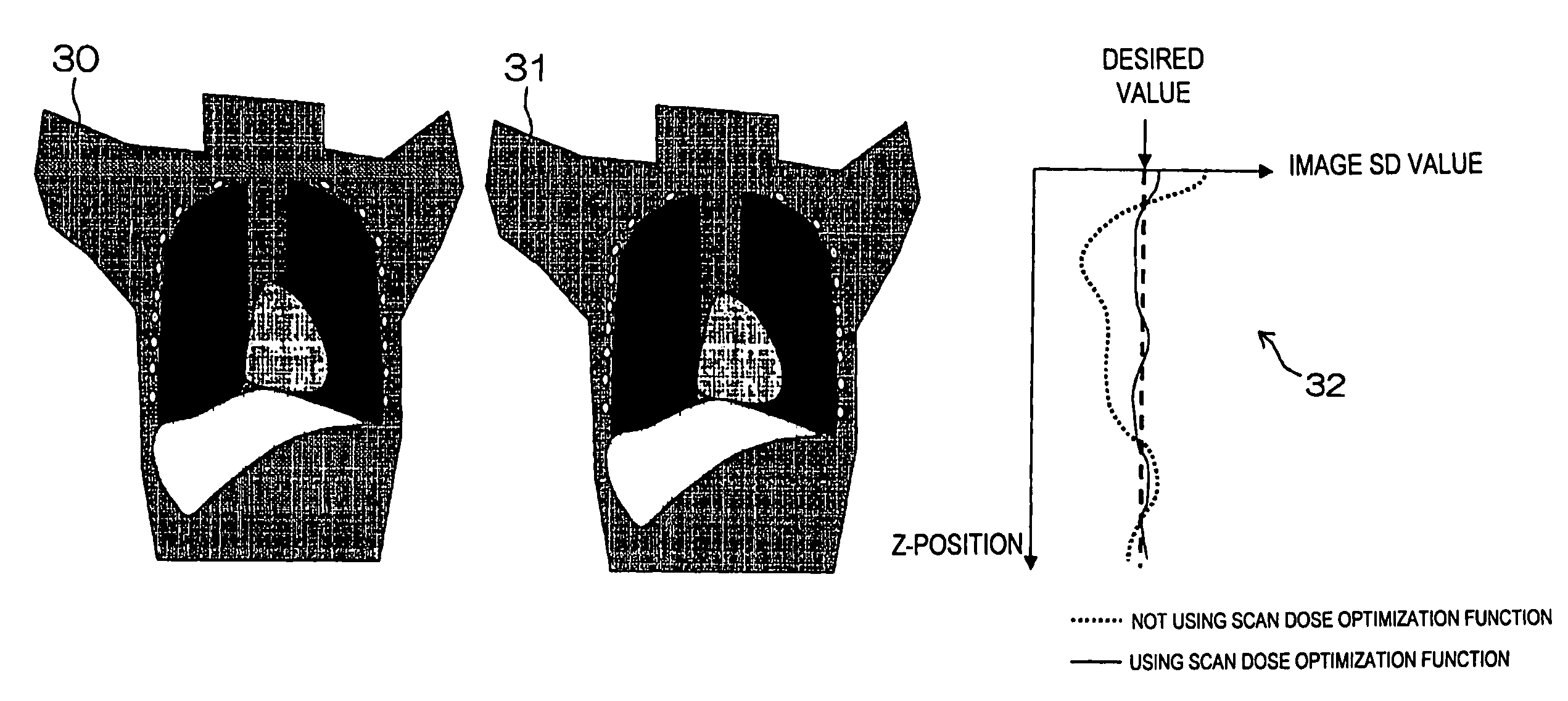 X-ray CT apparatus