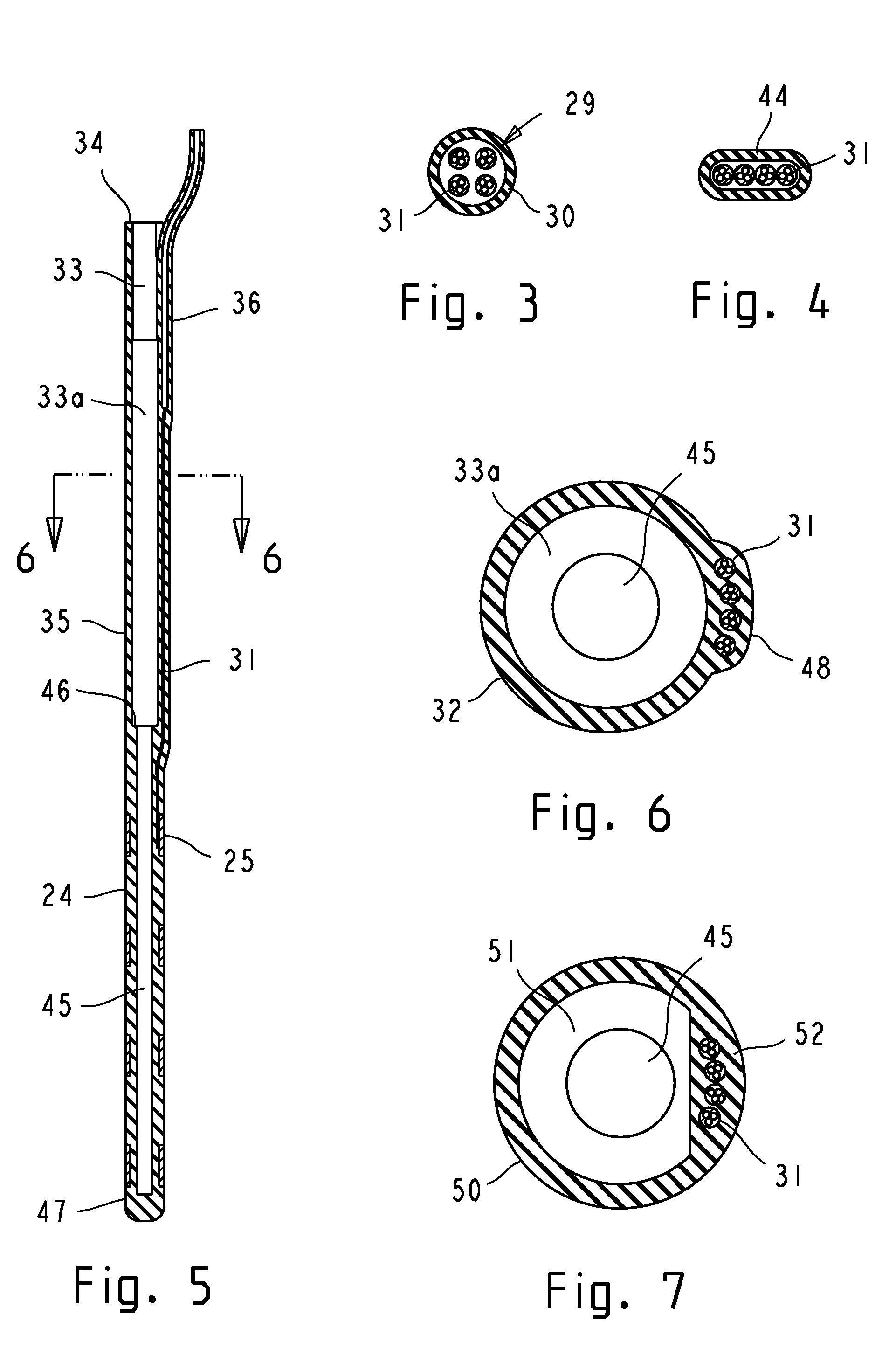 Implantable lead and accessories