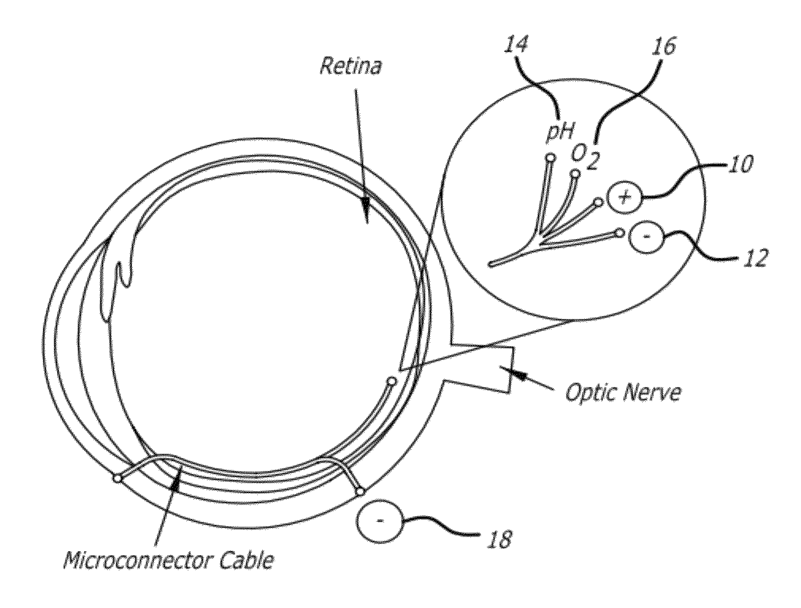 Method and apparatus for treating ischemic diseases