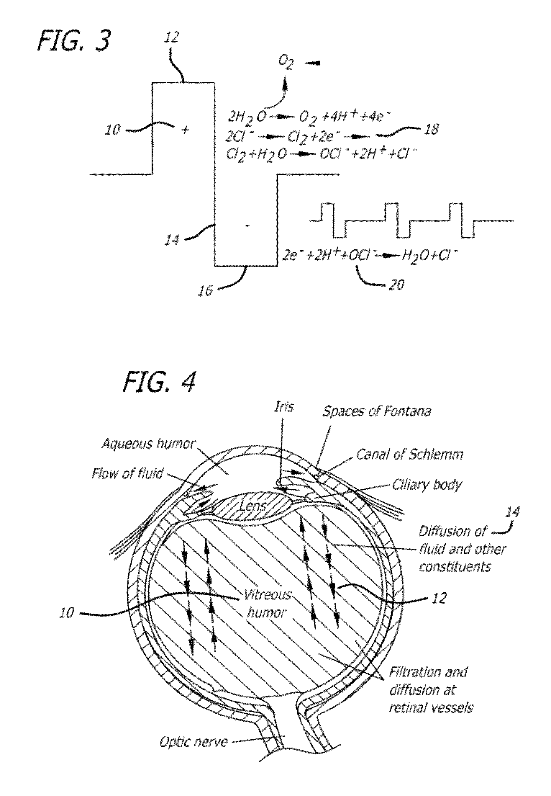 Method and apparatus for treating ischemic diseases