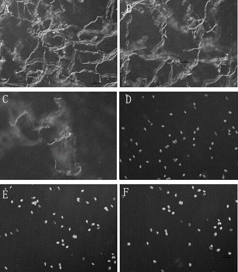 Application of rice base rot antibiotic zeamines in plant disease control