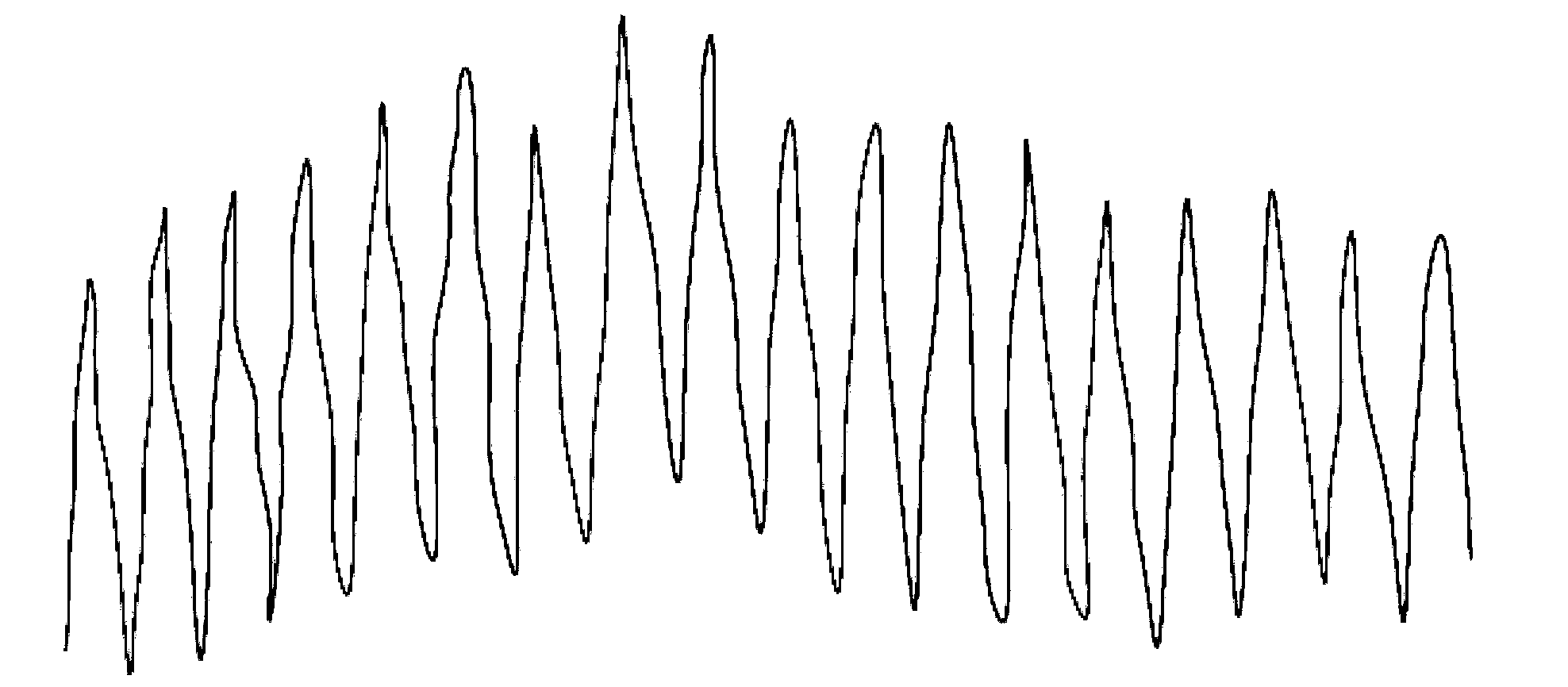 User recognition method, physiological detection device and physiological detection method