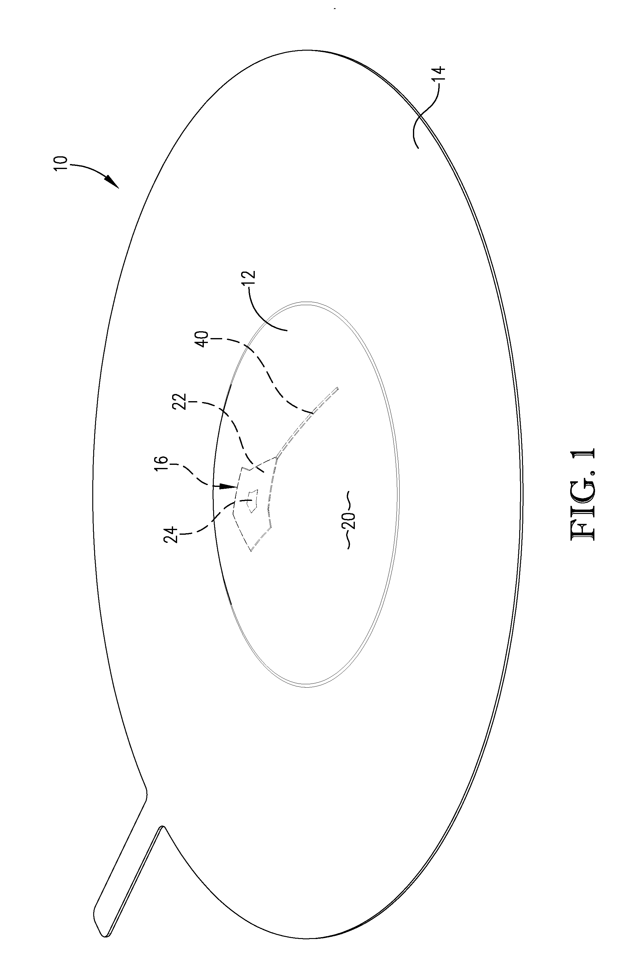 Rupture disc having laser-defined reversal initiation and deformation control features