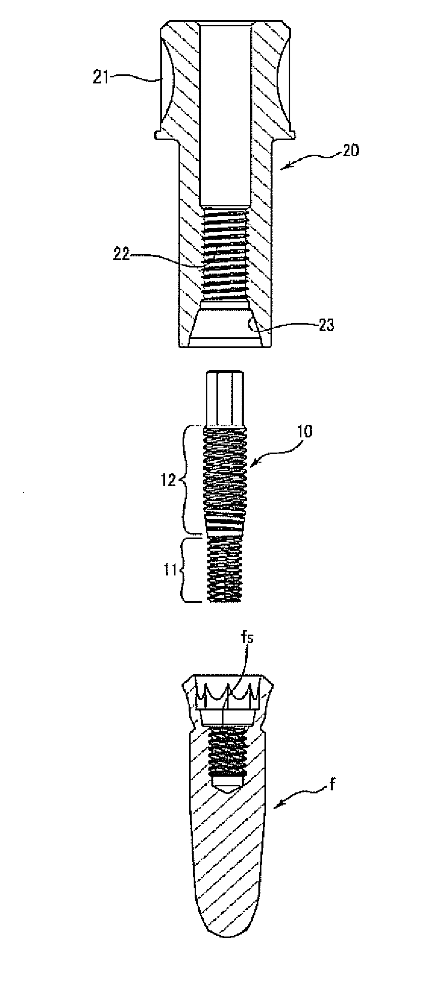 Implant fixture remover