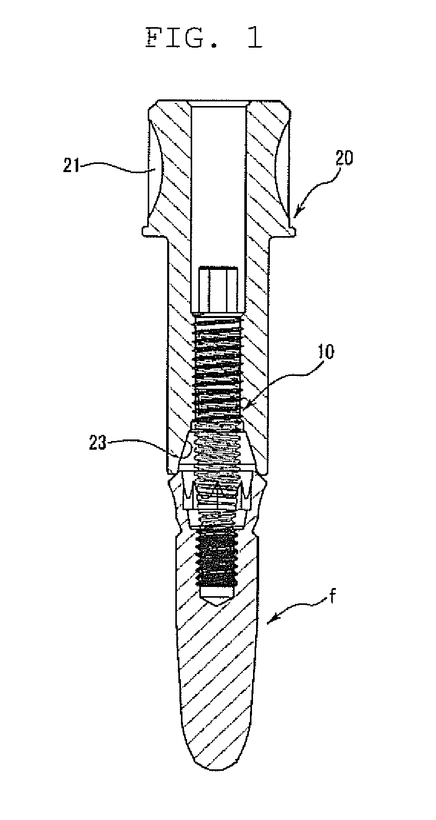 Implant fixture remover