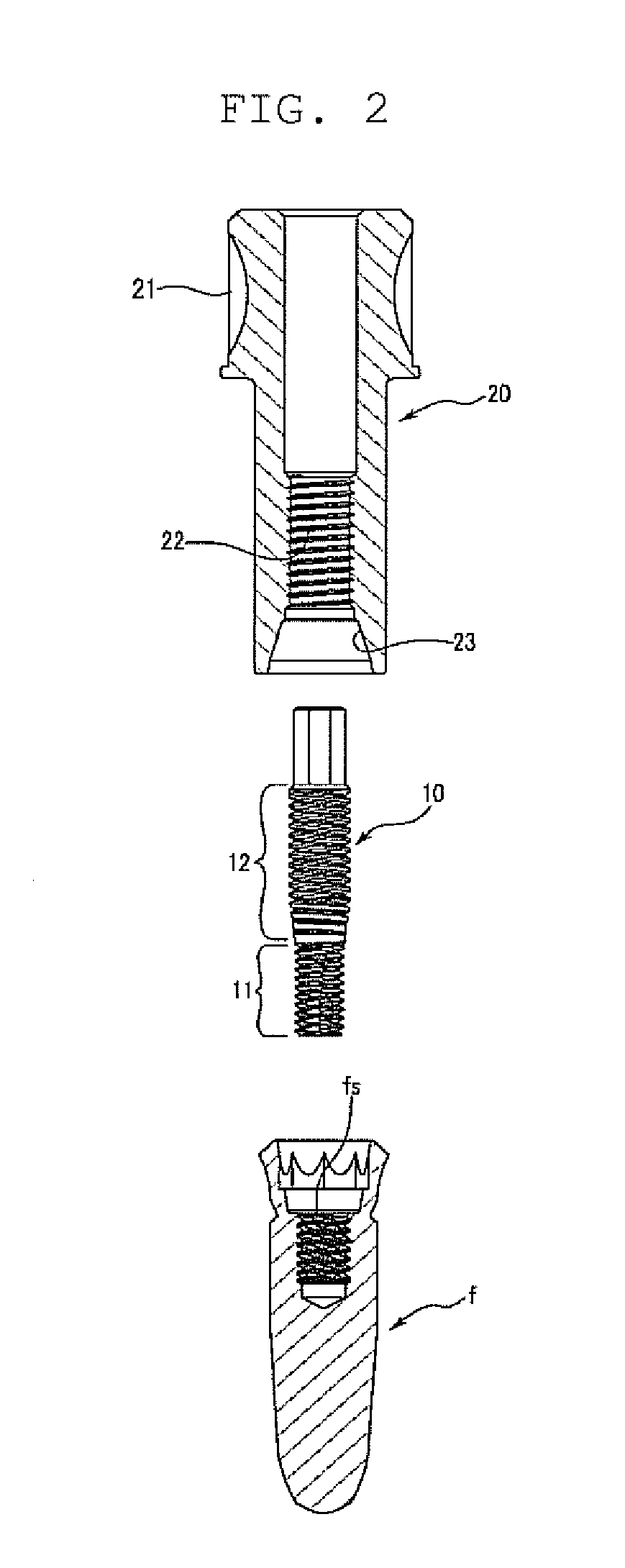 Implant fixture remover