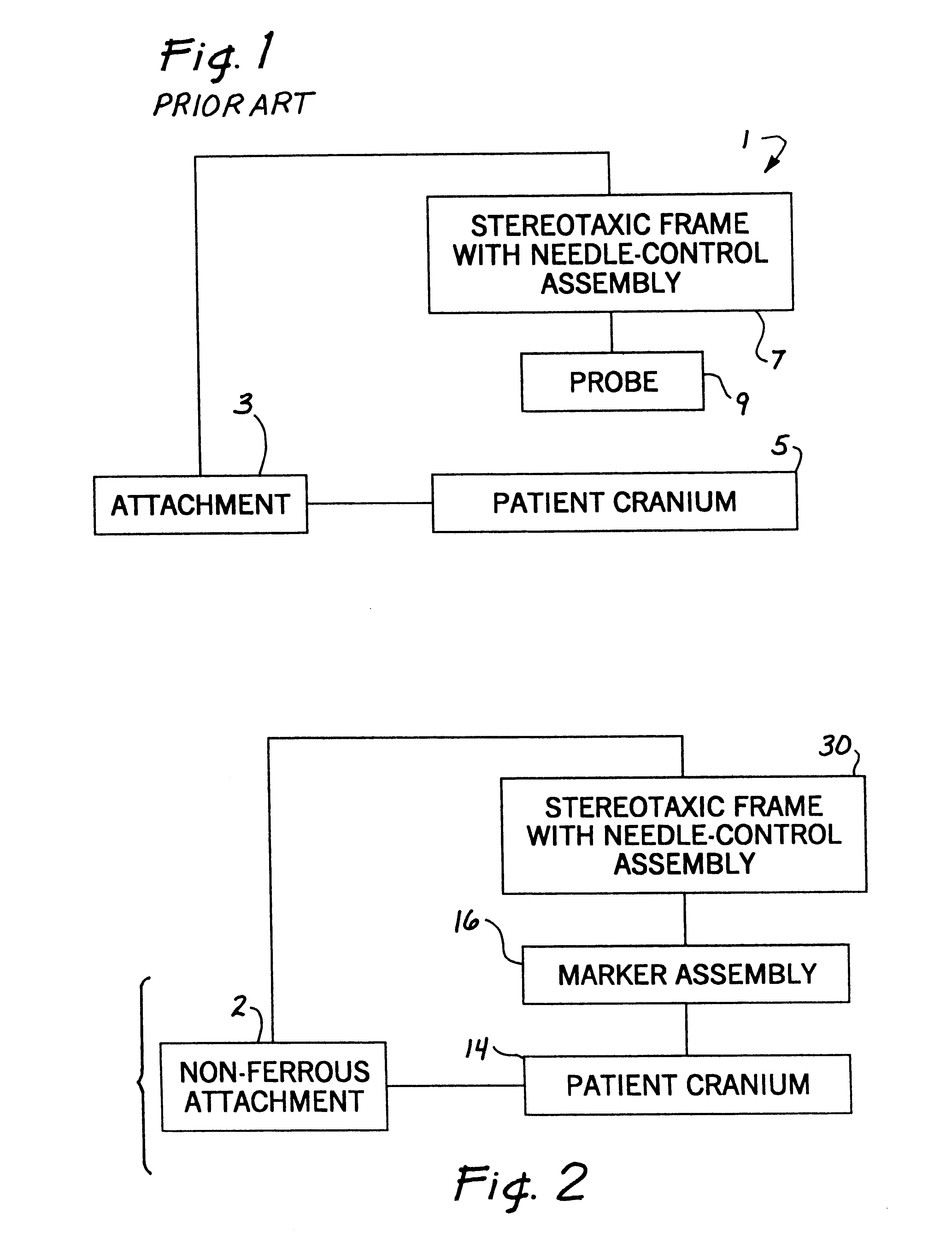 Stereotaxic detachable needle extension