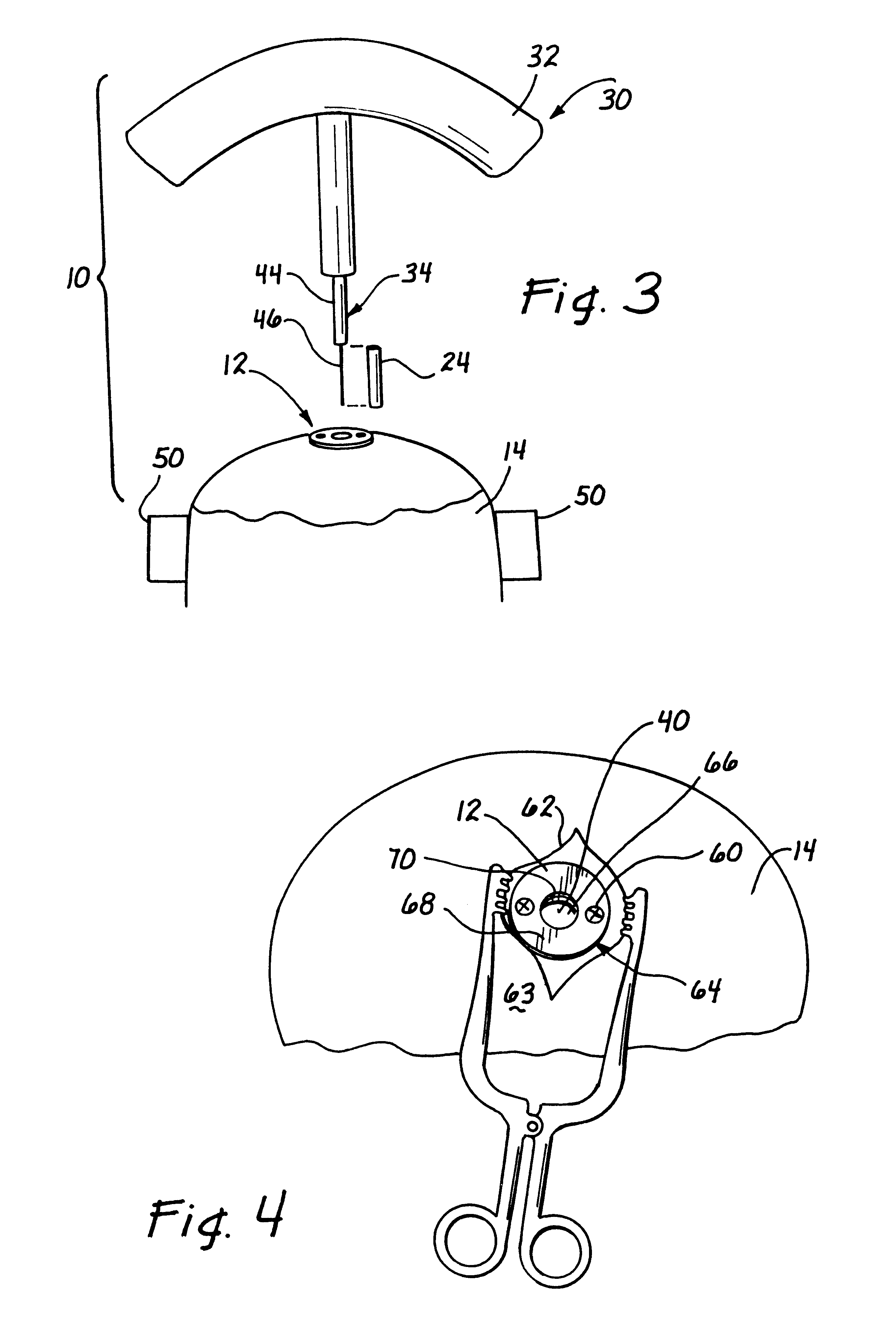 Stereotaxic detachable needle extension