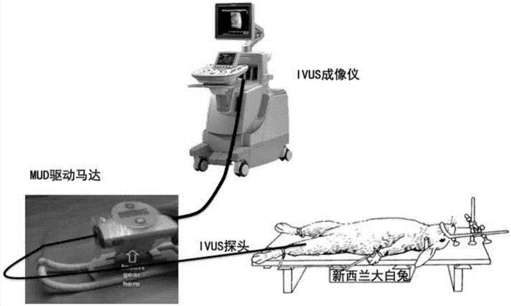 Modeling method for new blood vessels in abdominal aorta atherosclerotic plaques of New Zealand white rabbit