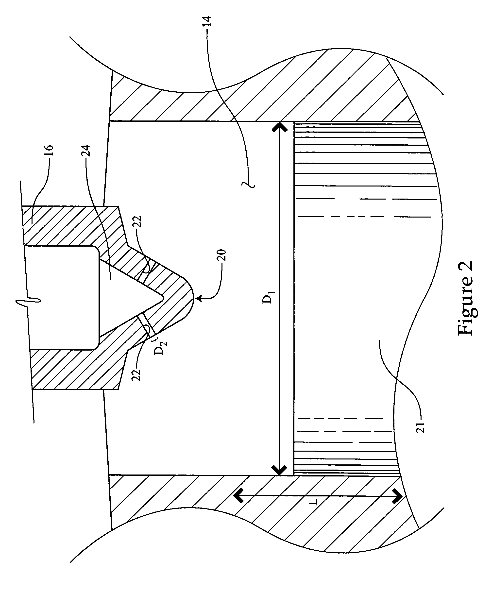 Internal combustion engine