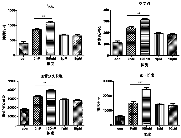 Preparation for conditional medium of umbilical cord mesenchymal stem cells for enhancing autophagy and application thereof in angiogenesis