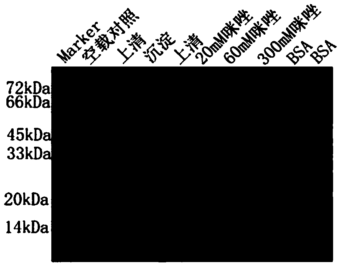 Bovine coronavirus VPN (virtal private network) gene, encoded recombinant protein and application thereof