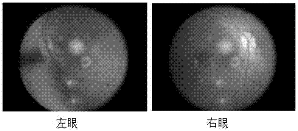 A method for high-fat induced primate macular degeneration model