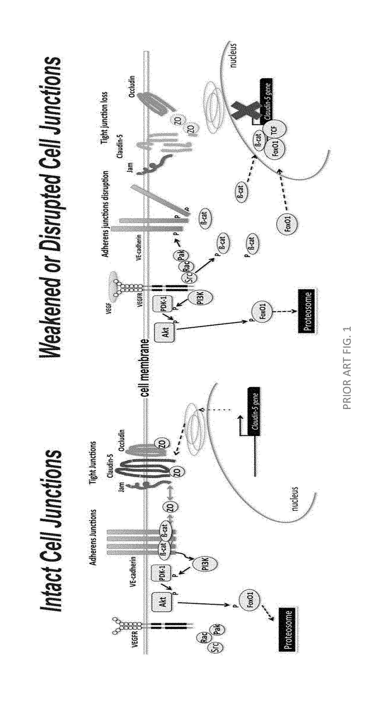 Norrin regulation of junction proteins and the use thereof to treat epithelial or endothelial membrane leakage induced edema