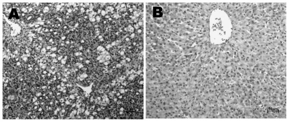 Method for constructing liver and immune double-humanized large animal model by utilizing single stem cell transplantation