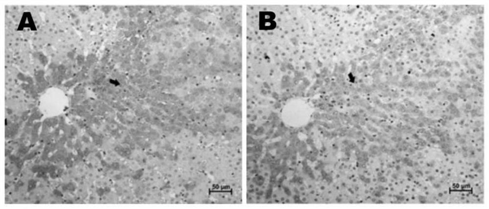 Method for constructing liver and immune double-humanized large animal model by utilizing single stem cell transplantation