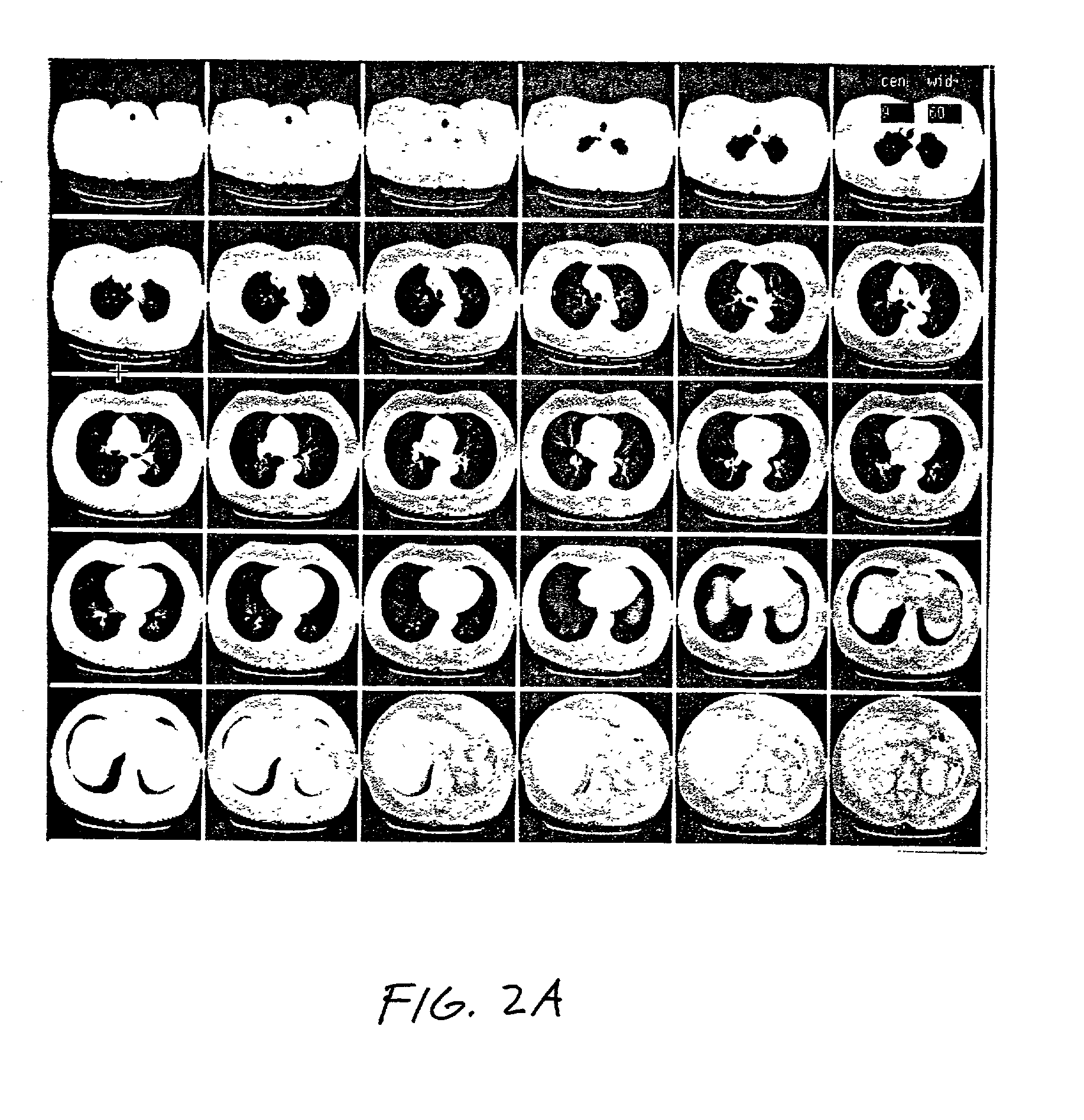 Method and system for the automated temporal subtraction of medical images