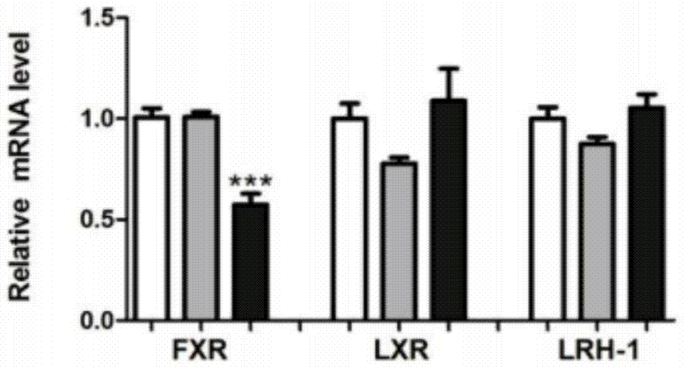 Application of farnesoid X receptor stimulant GW4064 in preparation of medicine for treating non-alcoholic fatty liver disease (NAFLD) caused by senescence