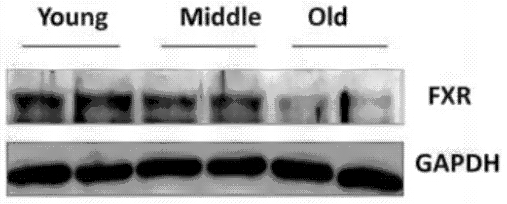 Application of farnesoid X receptor stimulant GW4064 in preparation of medicine for treating non-alcoholic fatty liver disease (NAFLD) caused by senescence