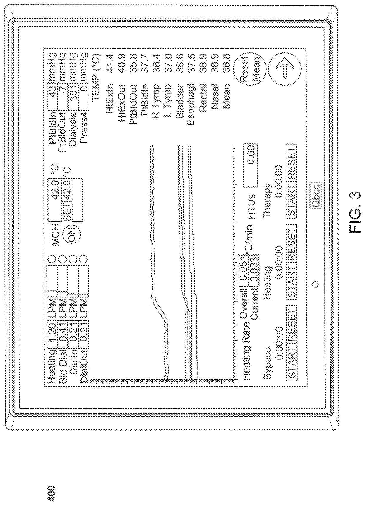 Method and system for controlled hyperthermia