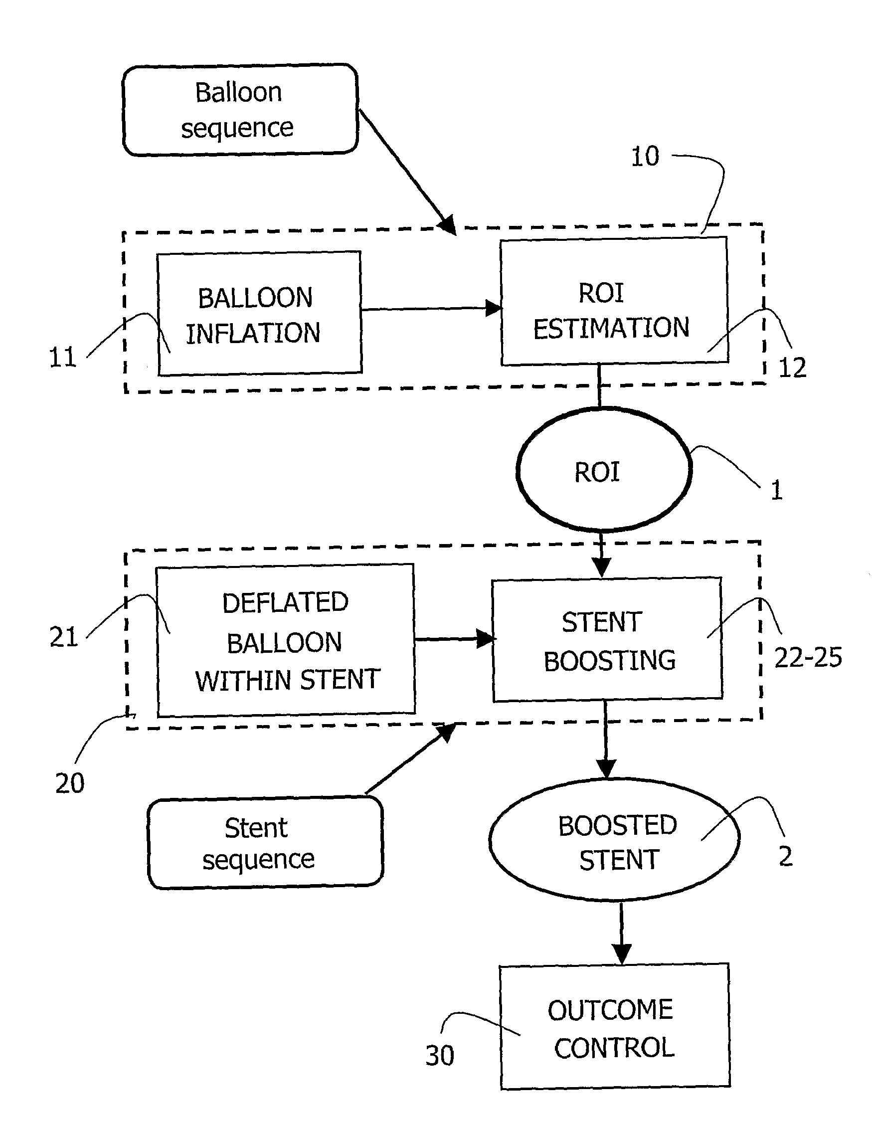 Viewing System for Control of Ptca Angiograms