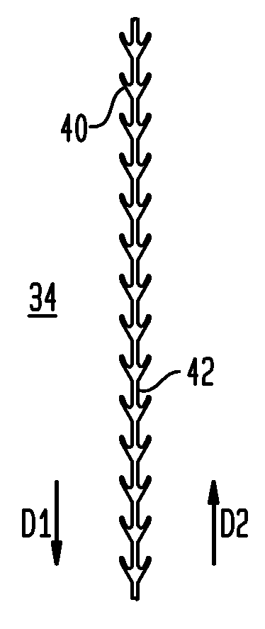 Implant systems and methods for treating obstructive sleep apnea