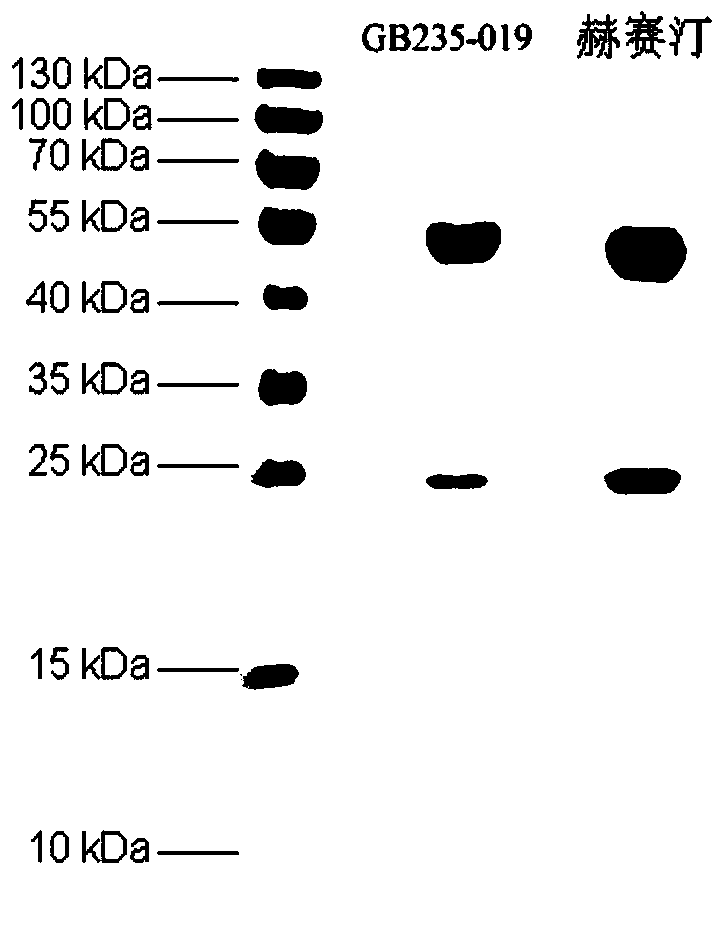 A fully human her2 antibody, its coding gene and application