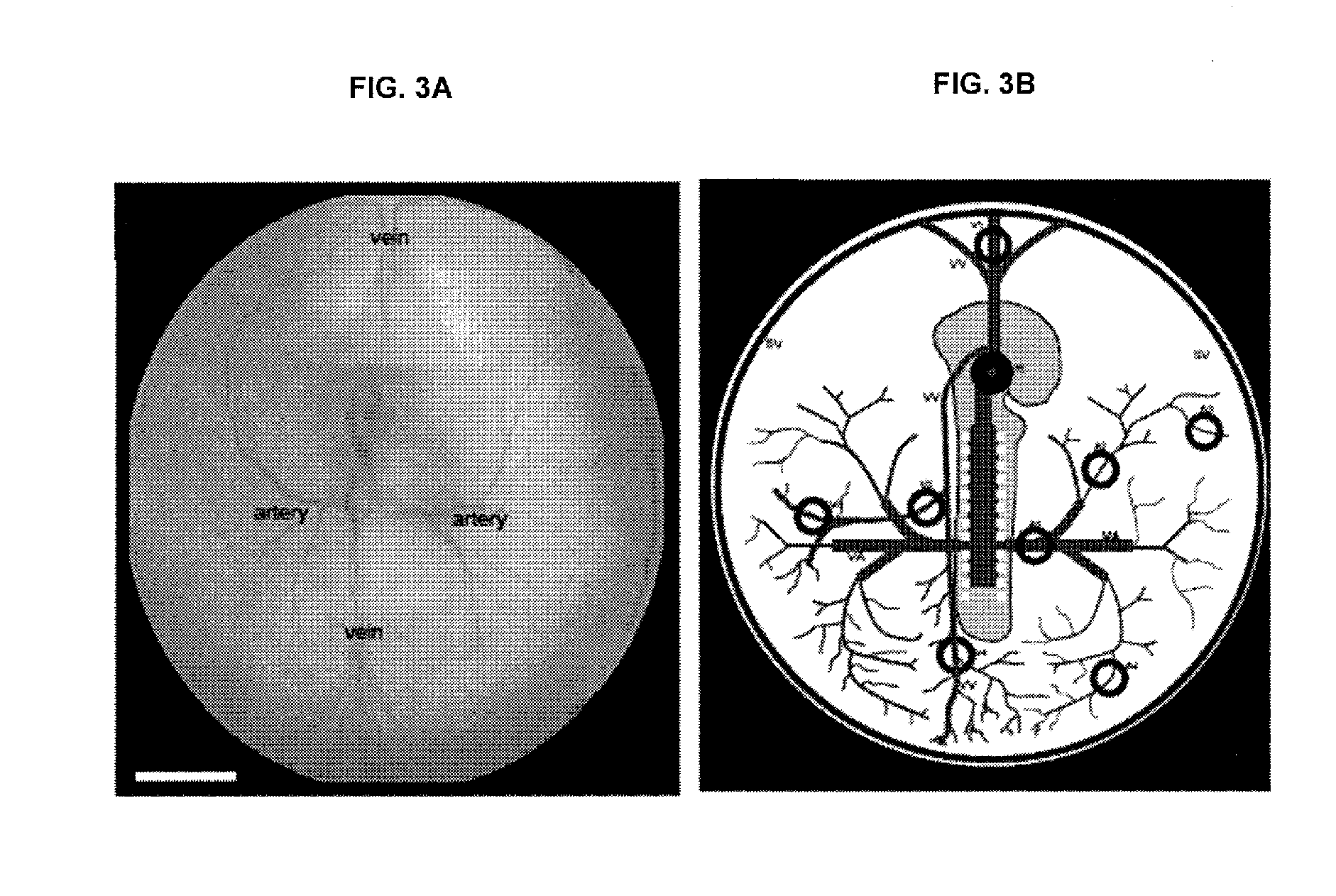 Method and device for monitoring and improving arteriogenesis