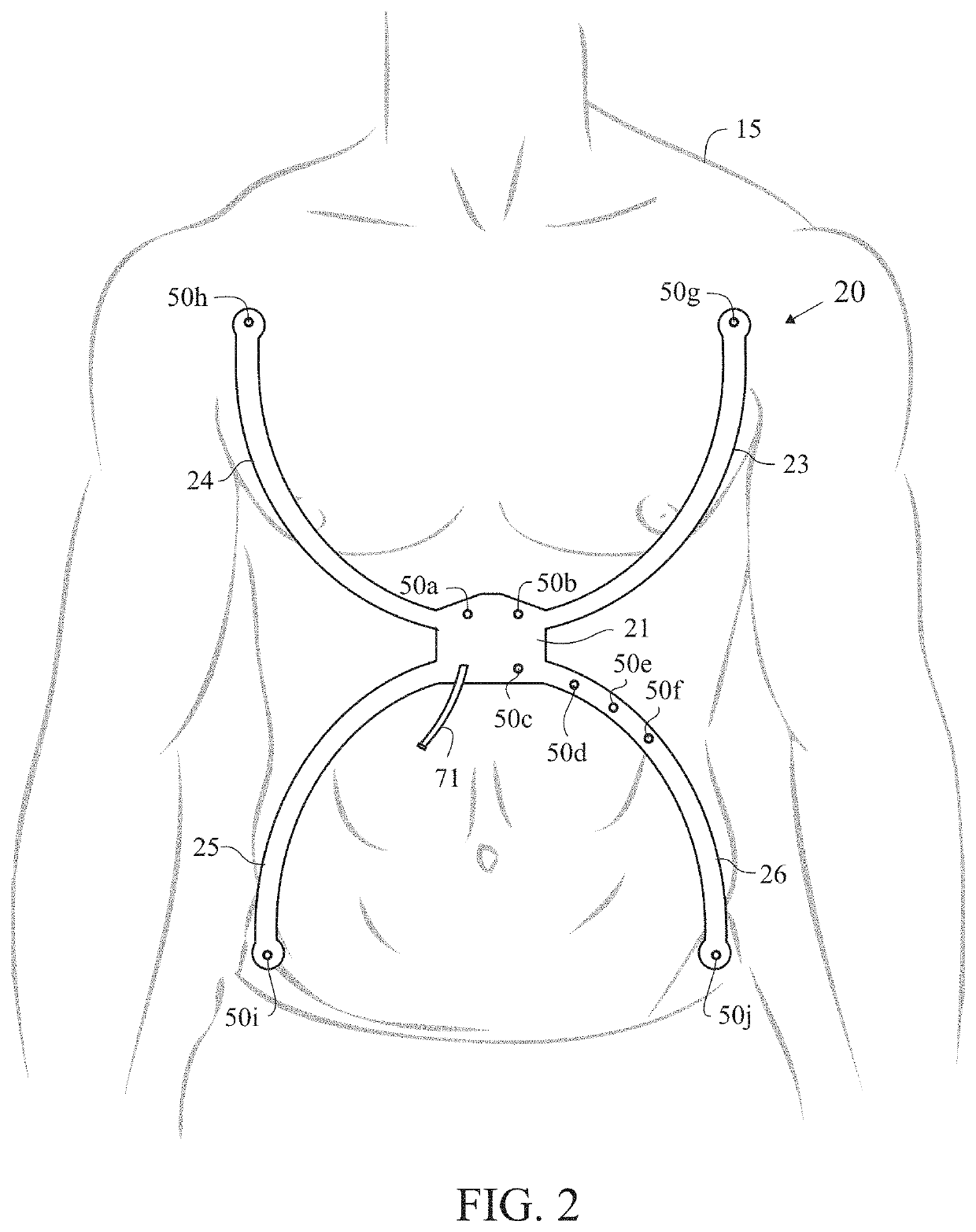 Emergency cardiac and electrocardiogram electrode placement system