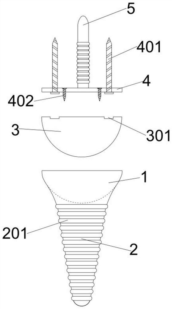 Wrist joint prosthesis with surface hydroxyapatite HA modified microporous titanium