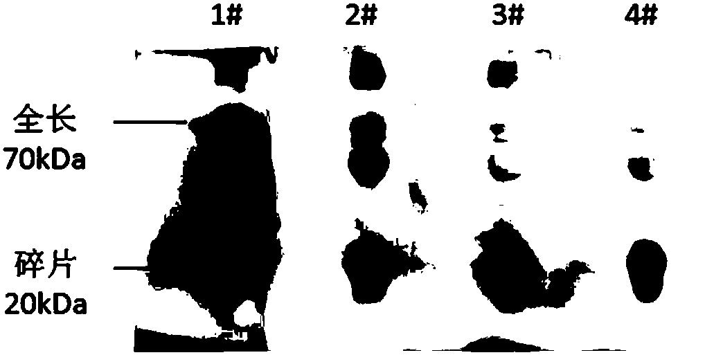 Antibody for detecting blood brain barrier early injury of cerebral arterial thrombosis and application of antibody