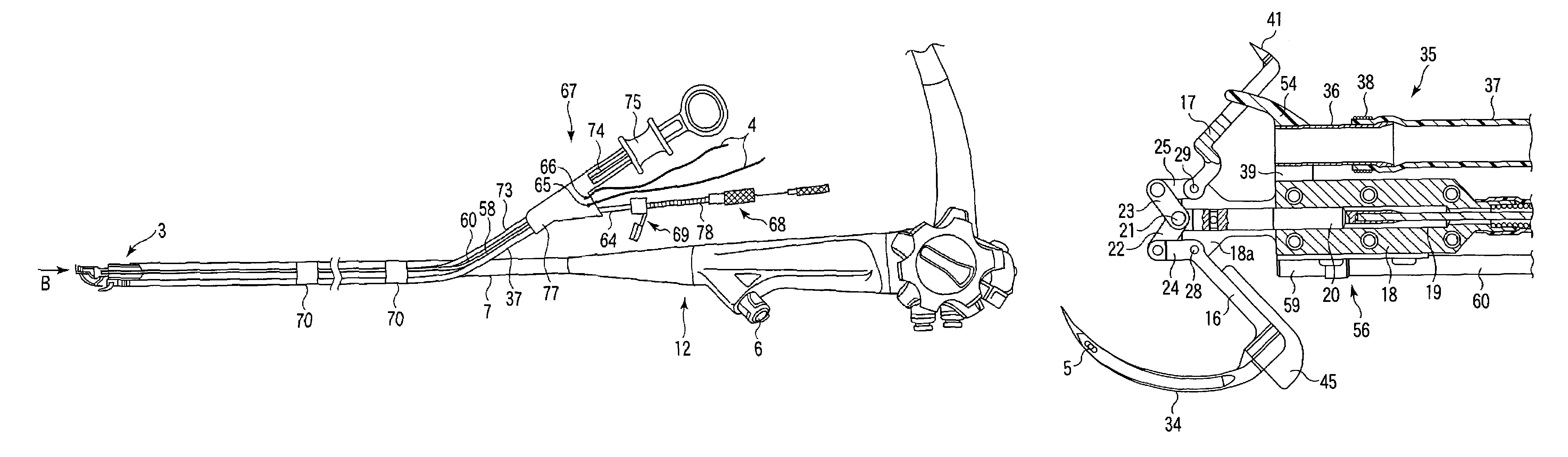 Endoscopic suturing system