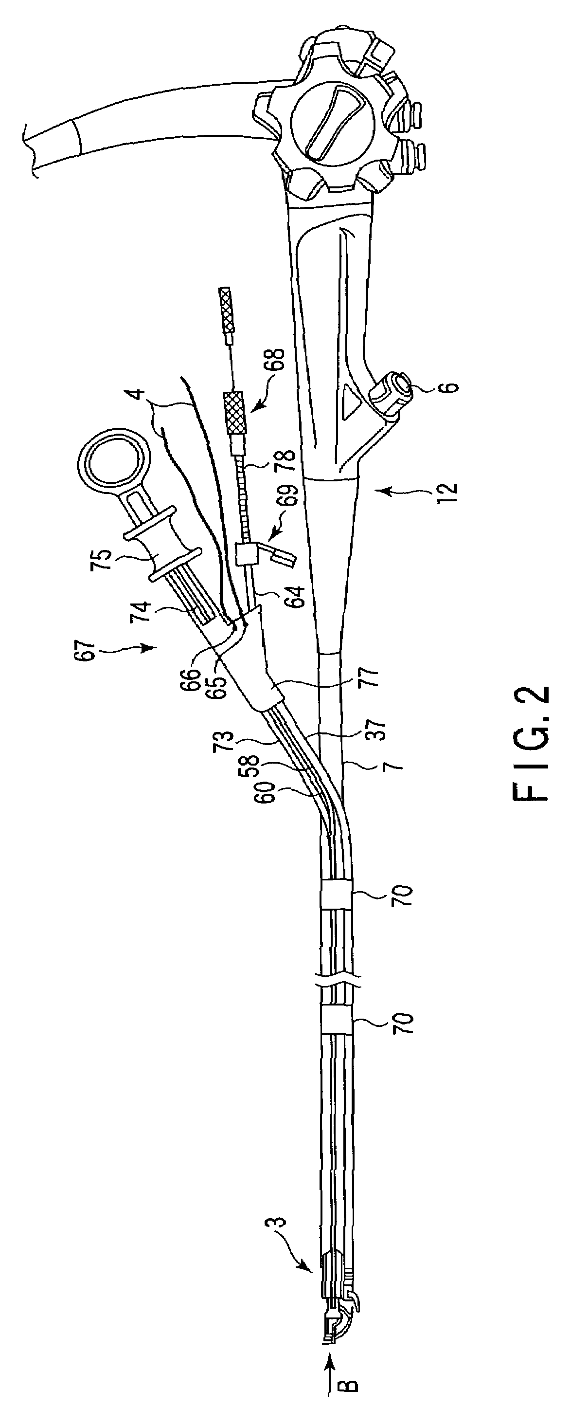 Endoscopic suturing system