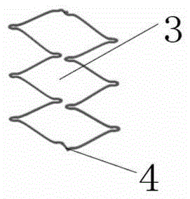 Carotid artery stent system