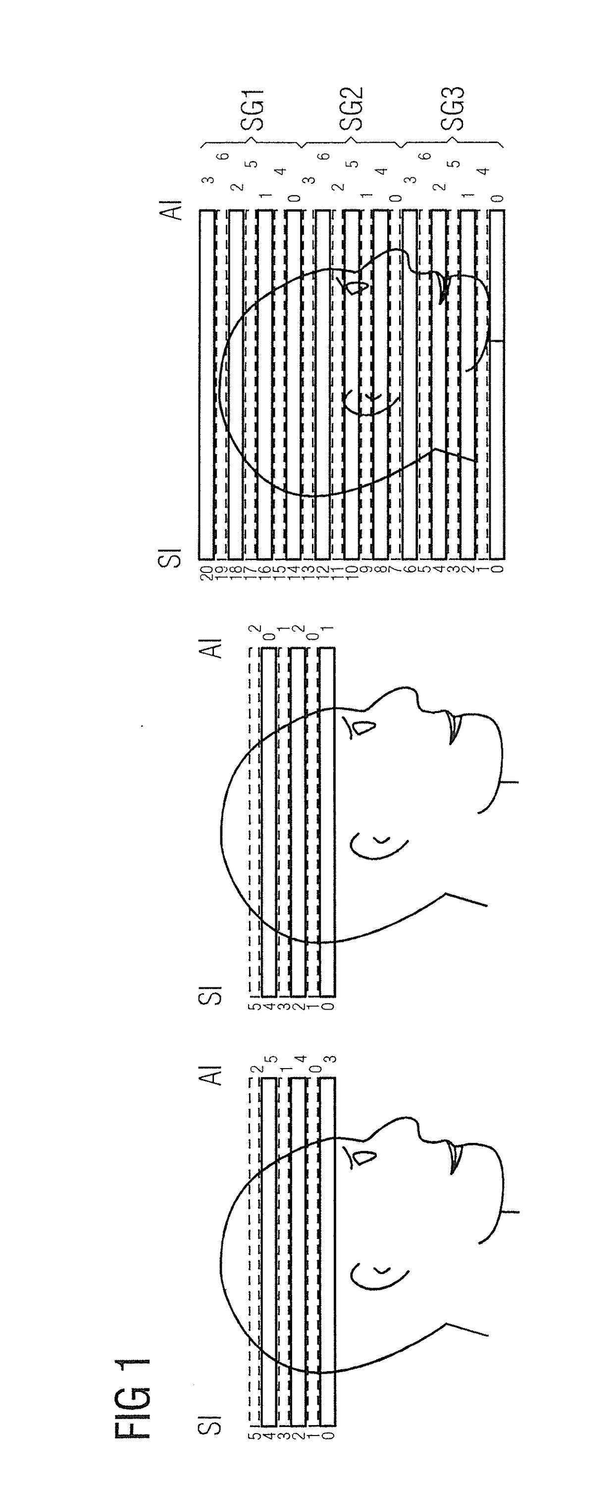 Method and apparatus for actuation of a magnetic resonance scanner for the simultaneous acquisition of multiple partial volumes