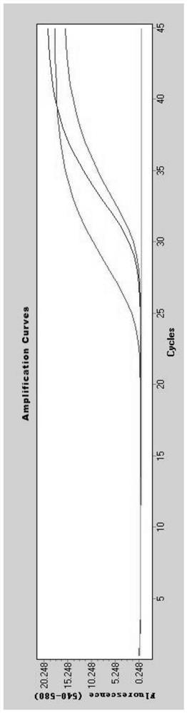 COVID-19 nucleic acid releasing agent and nucleic acid detection kit