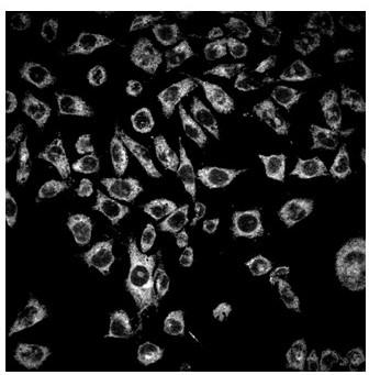 Fluorescent probe compound for selenium protein detection and preparation method thereof