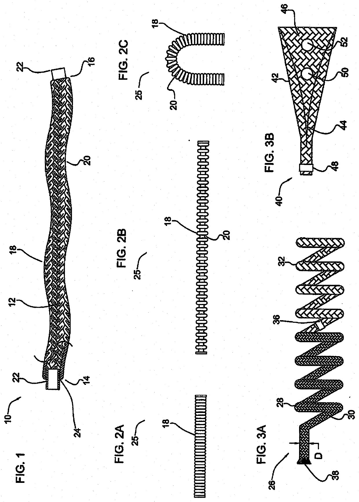 Vascular implant