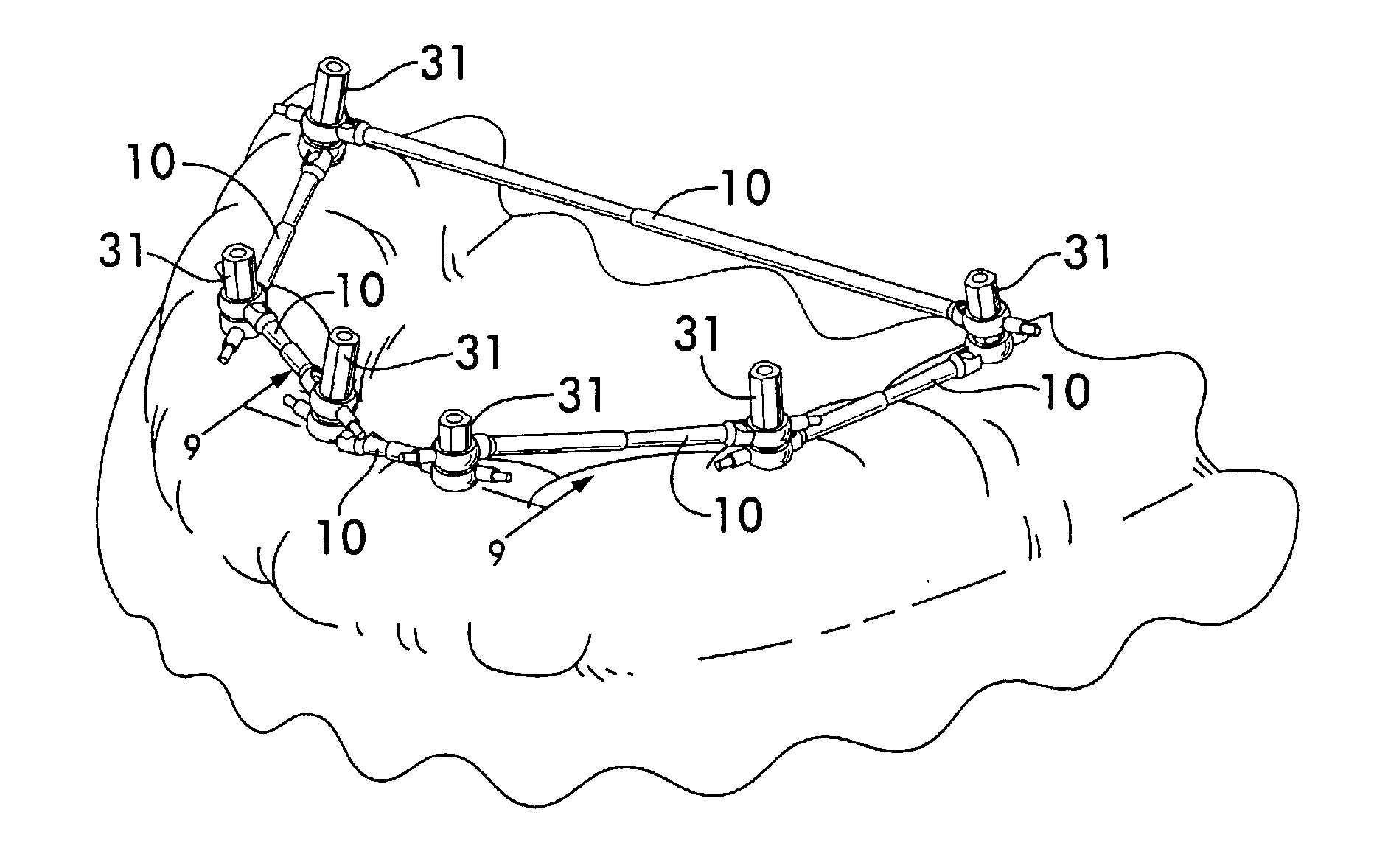 Impression support system for dental implants