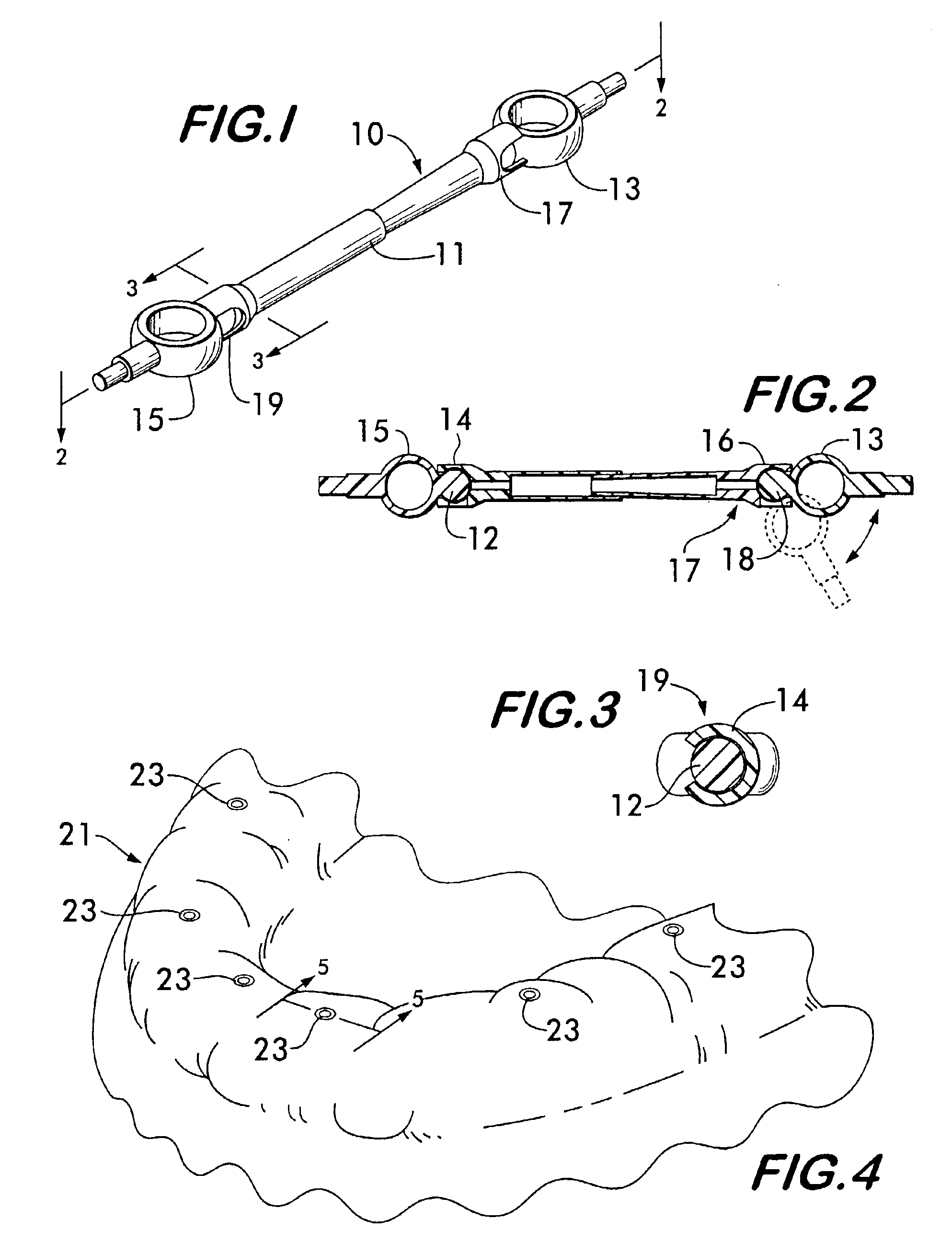 Impression support system for dental implants